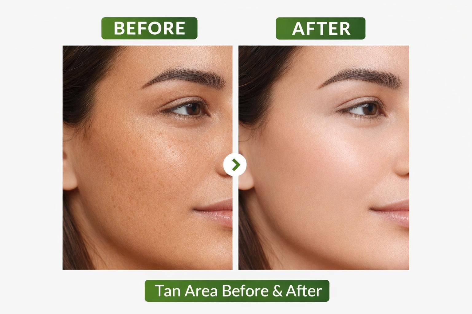Tan Removal